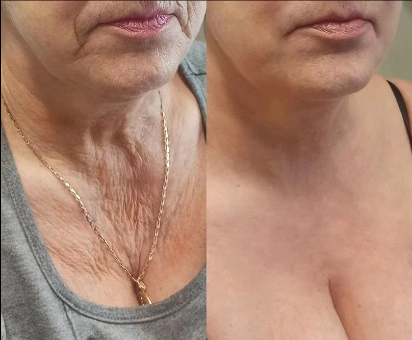 BOTOXIN™ Stick lifting di lusso con veleno d'ape e peptidi