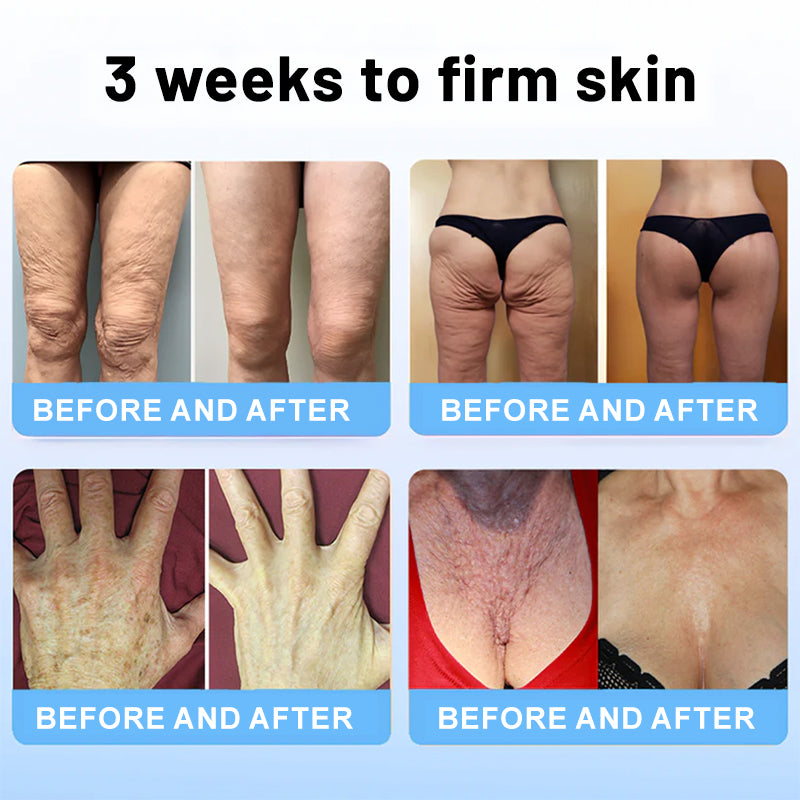 BOTOXIN™ Stick lifting di lusso con veleno d'ape e peptidi