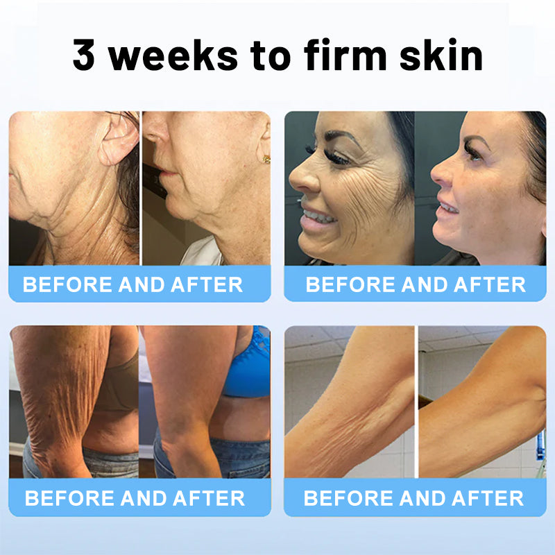 BOTOXIN™ Stick lifting di lusso con veleno d'ape e peptidi