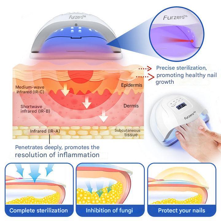 ClearZap™ Apparecchiature per la terapia laser degli stampi