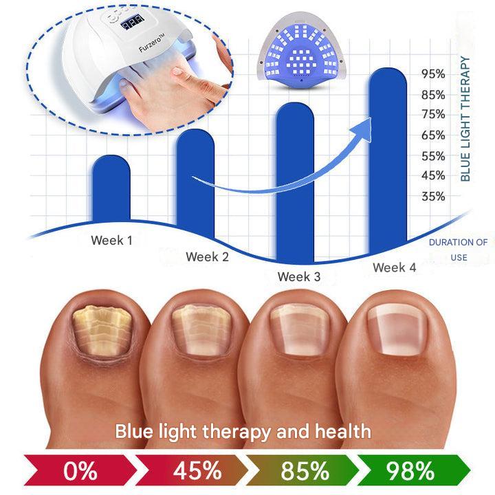 ClearZap™ Apparecchiature per la terapia laser degli stampi
