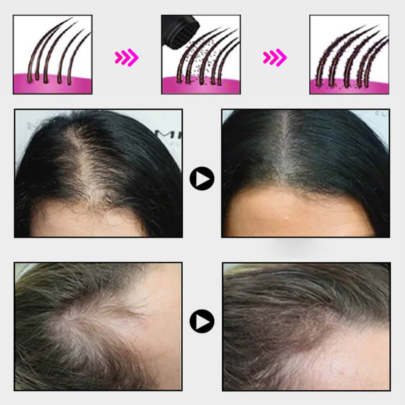 EELHOE HAIR™ Polvere contro la caduta dei capelli e riempimento rapido dell'attaccatura dei capelli