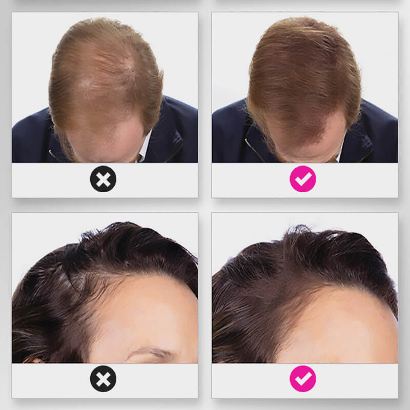 EELHOE HAIR™ Polvere contro la caduta dei capelli e riempimento rapido dell'attaccatura dei capelli
