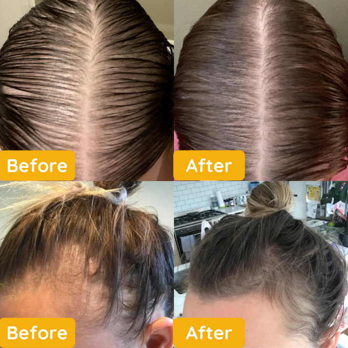 EELHOE Veghair™  Olio naturale vegano per la crescita dei capelli