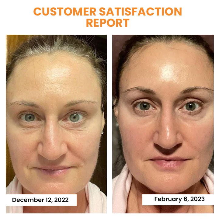 EELHOE™ Cosmetici antirughe 2 in 1