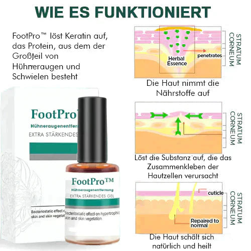 FootPro™️ Gel per la rimozione dei calli