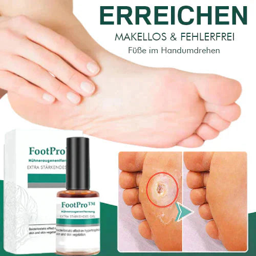 FootPro™️ Gel per la rimozione dei calli