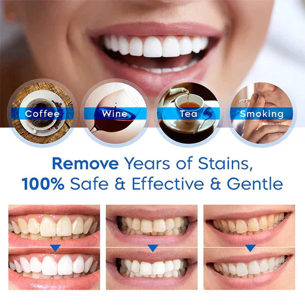 GlowDent™Siero sbiancante per denti