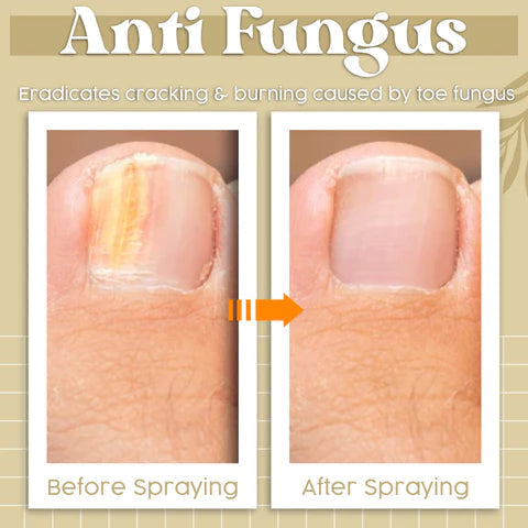Herbcure™ Spray antifungino