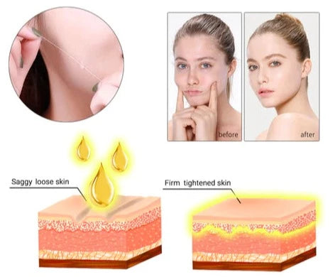 Instalift™ Kit lifting e ringiovanimento della pelle con filo proteico 24K