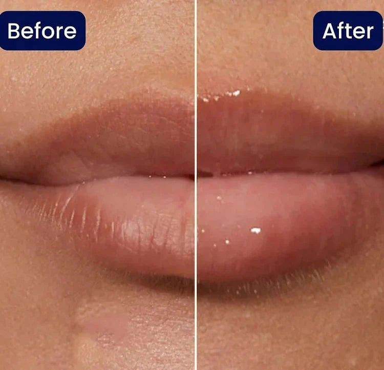 KissBeauty™ Rimpolpante labbra istantaneo