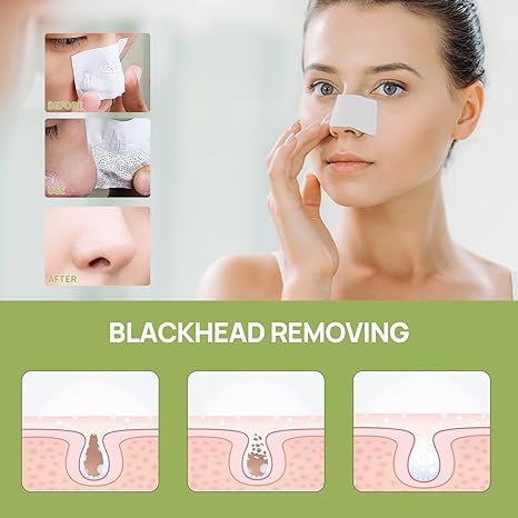 LANBENA™ Maschera esfoliante per la rimozione dei punti neri con 60 strisce