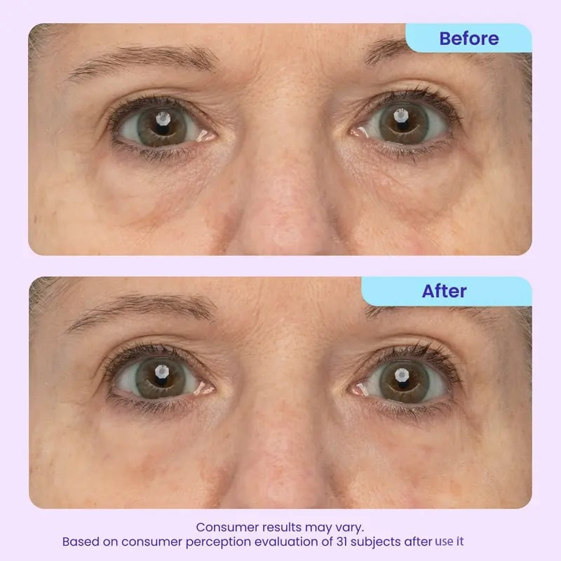 LiftVeil™ Gel occhi defaticante per mattine più distese