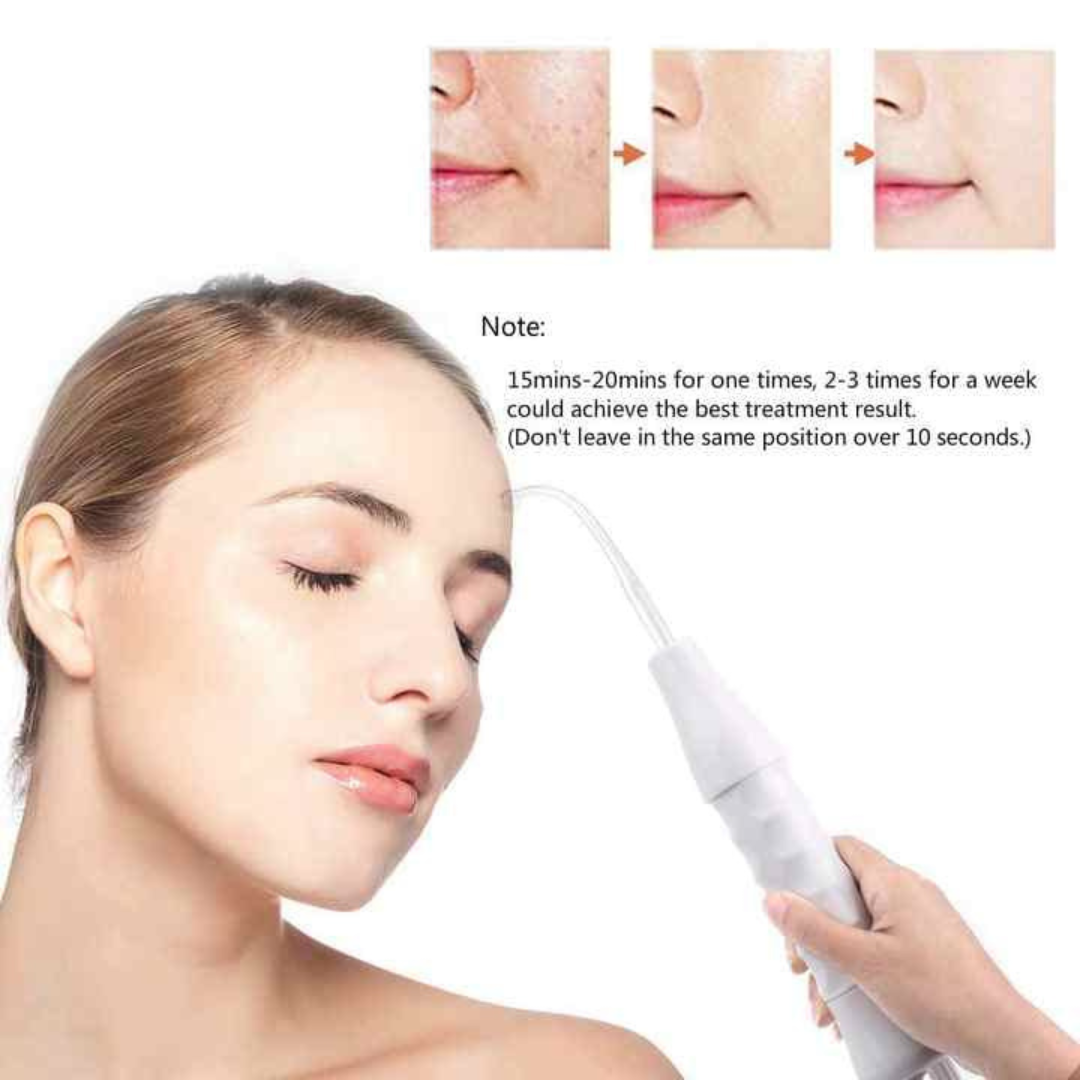 NueDerma™ Bacchetta per la cura della pelle ad alta frequenza