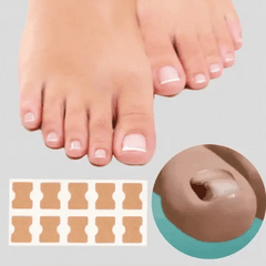 ToeFix+ Medicazioni per unghie | Sbarazzati dei funghi delle unghie per sempre!