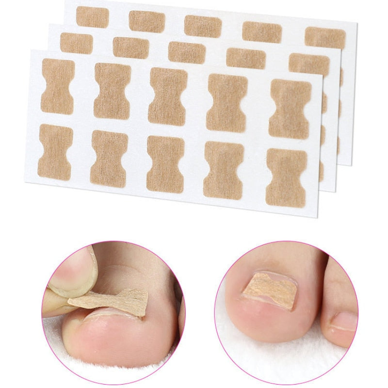 ToeFix+ Medicazioni per unghie | Sbarazzati dei funghi delle unghie per sempre!