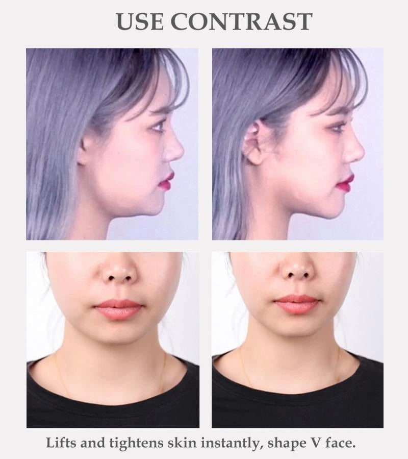 V-Lift™️ Striscia lifting invisibile per il viso