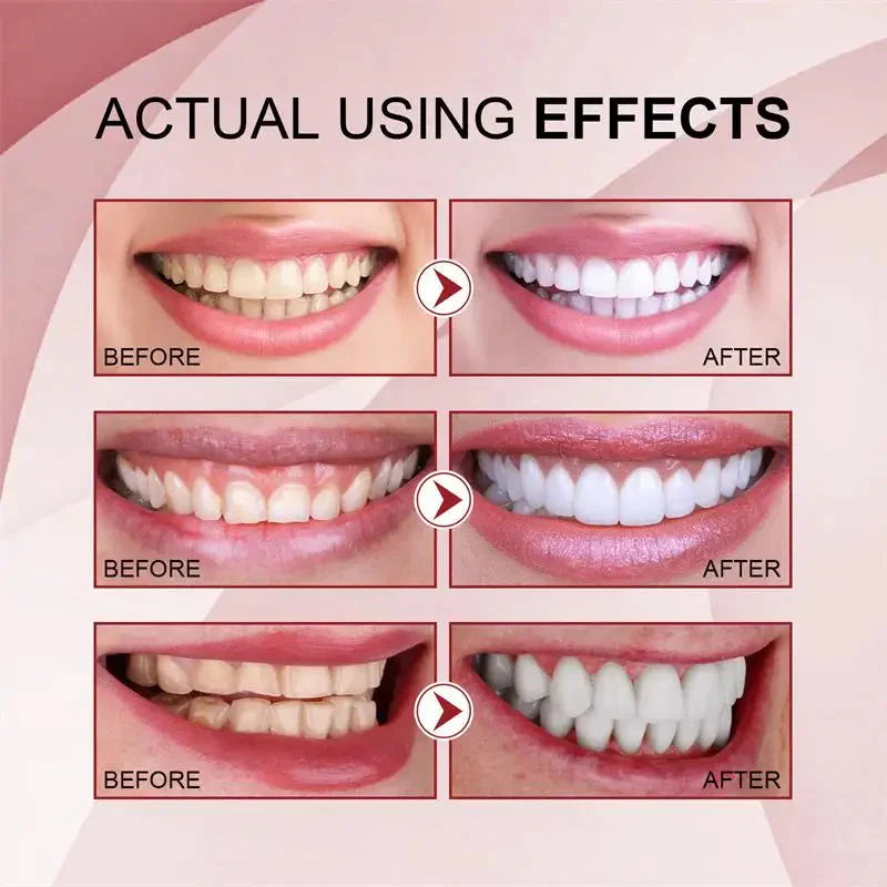 Vital Smile™ Super Probiotic-6 dentifricio con 6 probiotici