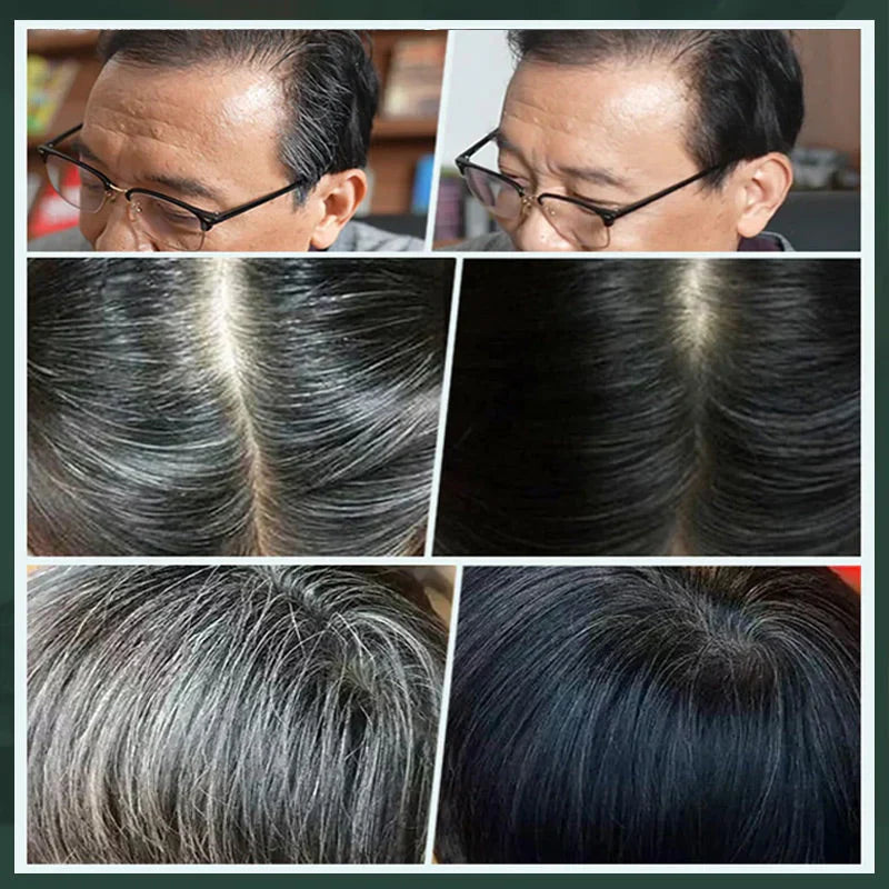 Combrané™ Tinta capelli delicata per colore scuro naturale