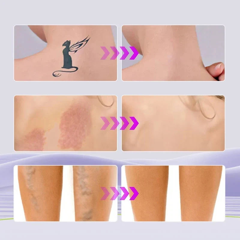 Covrané™ Make-up corpo waterproof per una pelle liscia e uniforme
