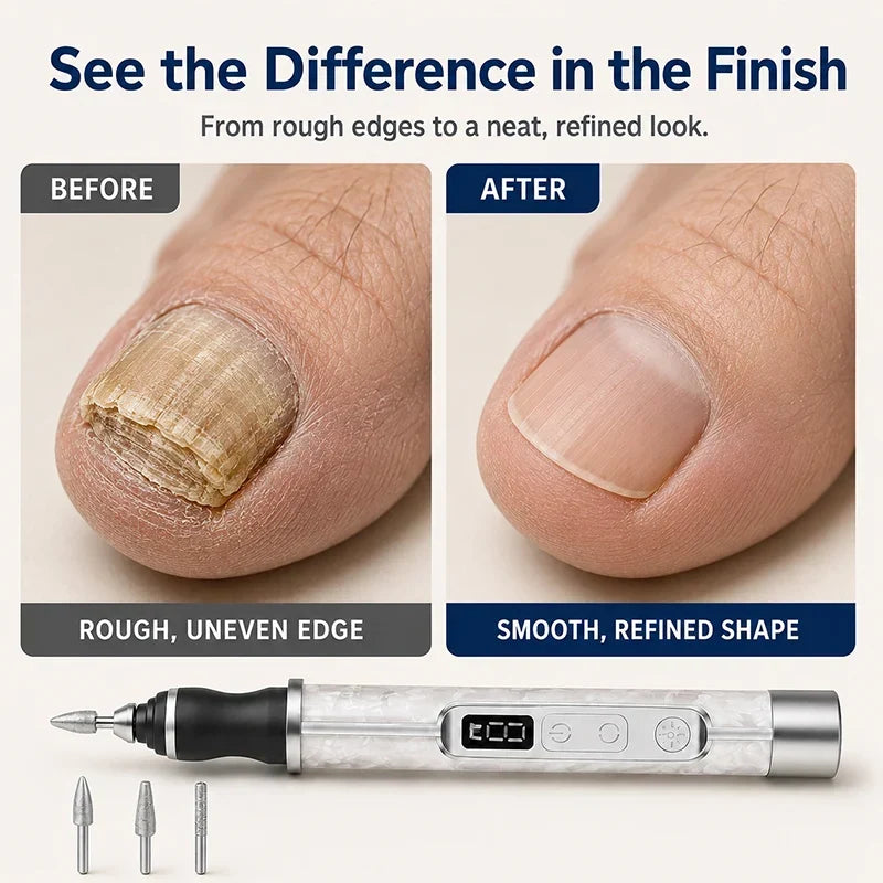 Lumériça™ Sistema manicure all-in-one a penna