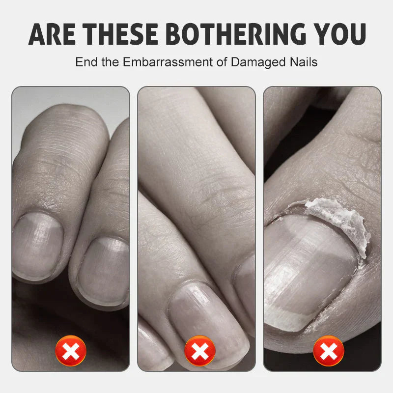 NourishNails™ Trattamento rigenerante per unghie lisce e sane