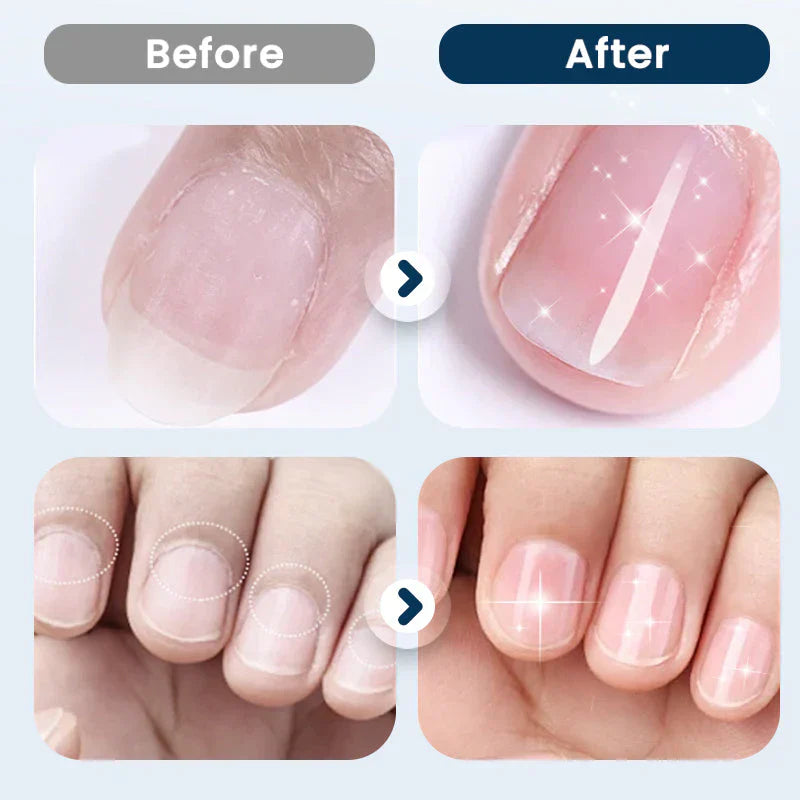 NourishNails™ Trattamento rigenerante per unghie lisce e sane